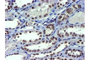 Image no. 4 for anti-Ubiquitin Specific Peptidase 7 (Herpes Virus-Associated) (USP7) antibody (ABIN1498592) (USP7 抗体)