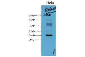 Western Blot (WB) analysis of HeLa, diluted at 1:3000. (Galectin 3 抗体)