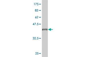Western Blot detection against Immunogen (37. (IL18RAP 抗体  (AA 20-129))