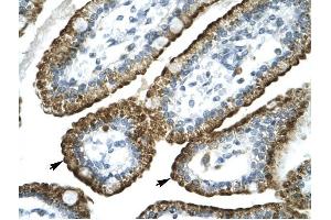 GABRP antibody was used for immunohistochemistry at a concentration of 4-8 ug/ml to stain Epithelial cells of intestinal villus (lndicated with Arrows) in Human Intestine. (GABRP 抗体  (N-Term))