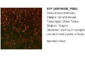 Image no. 2 for anti-Synaptophysin (SYP) (N-Term) antibody (ABIN2782216) (Synaptophysin 抗体  (N-Term))
