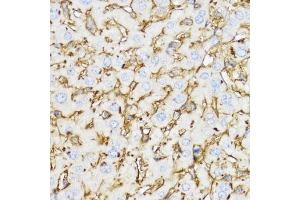 Immunohistochemistry of paraffin-embedded mouse liver using YKL-40/CHI3L1 antibody (ABIN3022444, ABIN3022445, ABIN3022446 and ABIN6218823) at dilution of 1:100 (40x lens).