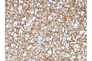 Formalin-fixed, paraffin-embedded human Brain stained with ARF1 Mouse Monoclonal Antibody (ARF1/2117). (ARF1 抗体)