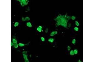 Image no. 3 for anti-T-Cell Acute Lymphocytic Leukemia 1 (TAL1) antibody (ABIN1501291)