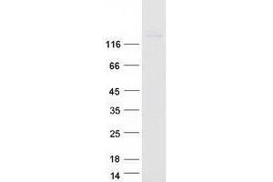 Western Blotting (WB) image for Neural Cell Adhesion Molecule 1 (NCAM1) (Transcript Variant 2) protein (Myc-DYKDDDDK Tag) (ABIN2713743)