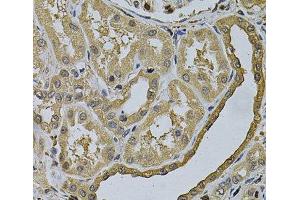 Immunohistochemistry of paraffin-embedded Human kidney using LCP1 Polyclonal Antibody at dilution of 1:100 (40x lens). (LCP1 抗体)