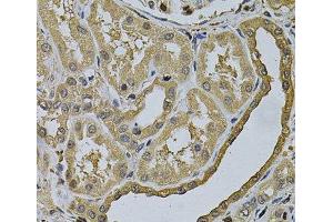 Immunohistochemistry of paraffin-embedded Human kidney using LCP1 Polyclonal Antibody at dilution of 1:100 (40x lens). (LCP1 抗体)