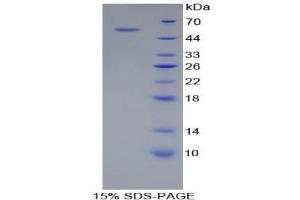 SDS-PAGE analysis of Pig Adiponectin Protein. (ADIPOQ 蛋白)