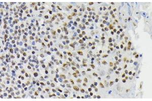 Immunohistochemistry of paraffin-embedded Human tonsil using Phospho-CREB1(S133) Polyclonal Antibody at dilution of 1:200 (40x lens). (CREB1 抗体  (pSer133))