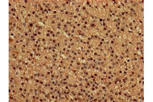 IHC image of ABIN7149549 diluted at 1:150 and staining in paraffin-embedded human adrenal gland tissue performed on a Leica BondTM system. (DAP 抗体  (AA 2-102))