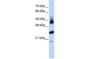 Western Blotting (WB) image for anti-F-Box and Leucine-Rich Repeat Protein 2 (FBXL2) antibody (ABIN2458705) (FBXL2 抗体)