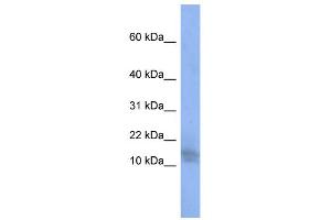 WB Suggested Anti-BRWD1 Antibody Titration:  0. (BRWD1 抗体  (N-Term))