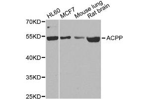 Western blot analysis of extracts of various cell lines, using ACPP antibody. (ACPP 抗体)