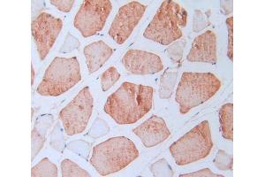 IHC-P analysis of skeletal muscle tissue, with DAB staining. (LOXL2 抗体  (AA 434-546))