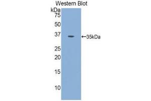 Western Blotting (WB) image for anti-Insulin Receptor (INSR) (AA 1024-1298) antibody (ABIN1078206) (Insulin Receptor 抗体  (AA 1024-1298))