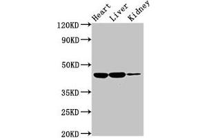 Western Blot Positive WB detected in: Rat heart tissue, Rat liver tissue, Rat kidney tissue All lanes: IL10RB antibody at 2 μg/mL Secondary Goat polyclonal to rabbit IgG at 1/50000 dilution Predicted band size: 37 kDa Observed band size: 45 kDa (IL1R2 抗体  (AA 79-219))