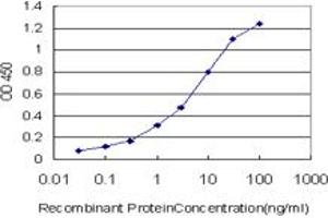 Detection limit for recombinant GST tagged RORB is approximately 0. (RORB 抗体  (AA 136-224))