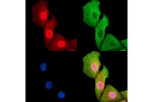 ABIN7095242 and ABIN7099299 staining Hela cells by IF/ICC. (RNF43 抗体)