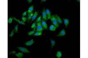 Immunofluorescence staining of Hela cells with ABIN7155501 at 1:133, counter-stained with DAPI. (WHSC1 抗体  (AA 1-44))