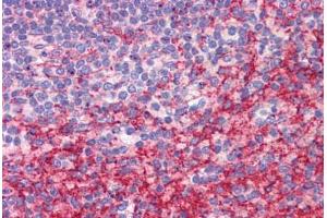 Human Spleen: Formalin-Fixed, Paraffin-Embedded (FFPE) (ATG9B 抗体  (C-Term))