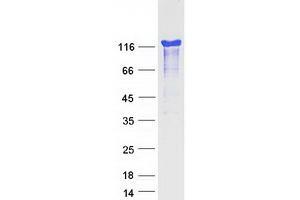 HDGFRP2 Protein (Transcript Variant 2) (Myc-DYKDDDDK Tag)