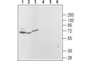 Western blot analysis of rat brain (lanes 1 and 4), kidney (lanes 2 and 5) and pancreas (lanes 3 and 6): - 1,2,3. (Mucolipin 3 抗体  (Cytoplasmic Domain, Intracellular))