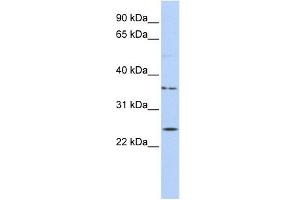 IQCF1 antibody used at 1 ug/ml to detect target protein. (IQCF1 抗体  (Middle Region))