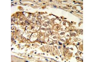 Immunohistochemistry (IHC) image for anti-Induced Myeloid Leukemia Cell Differentiation Protein Mcl-1 (MCL1) (AA 191-226) antibody (ABIN3031299)