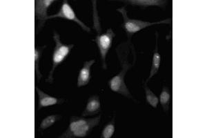 Immunofluorescent staining of HeLa (ATCC CCL-2) cells. (CDK2 抗体  (AA 109-298))
