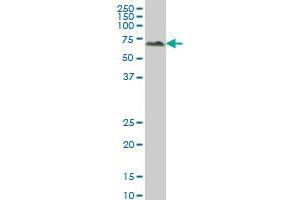 ALPPL2 monoclonal antibody (M07), clone 2B3 Western Blot analysis of ALPPL2 expression in A-431 . (ALPPL2 抗体  (AA 365-454))