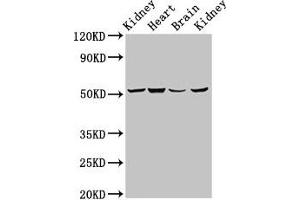 Western Blot Positive WB detected in: Rat kidney tissue, Mouse heart tissue, Mouse brain tissue, Mouse kidney tissue All lanes: NDUFS2 antibody at 6. (NDUFS2 抗体  (AA 297-427))