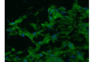 Image no. 2 for anti-Smoothelin (SMTN) antibody (ABIN335397) (Smoothelin 抗体)