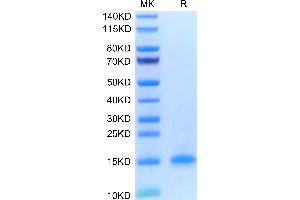 Human CD3 delta on Tris-Bis PAGE under reduced condition. (CD3D Protein (AA 22-105) (His tag))