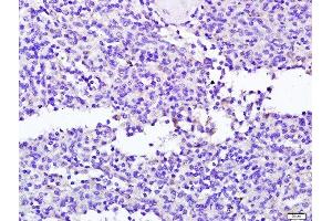 Paraformaldehyde-fixed, paraffin embedded human spleen tissue, Antigen retrieval by boiling in sodium citrate buffer(pH6) for 15min, Block endogenous peroxidase by 3% hydrogen peroxide for 30 minutes, Blocking buffer (normal goat serum) at 37°C for 20min, Antibody incubation with Rabbit Anti-NCR2 Polyclonal Antibody, Unconjugated  at 1:400 overnight at 4°C, followed by a conjugated secondary and DAB staining (NKp44/NCR2 抗体  (AA 201-276))