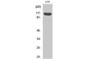 Western Blotting (WB) image for anti-HRS (HRS) (pTyr216) antibody (ABIN3172906) (HRS (HRS) (pTyr216) 抗体)