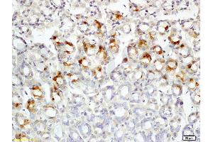 Formalin-fixed and paraffin embedded rat colon tissue labeled with Rabbit Anti-Leptin receptor(long) Polyclonal Antibody (ABIN725060) at 1:200 followed by conjugation to the secondary antibody and DAB staining. (Leptin Receptor 抗体  (AA 901-1000))
