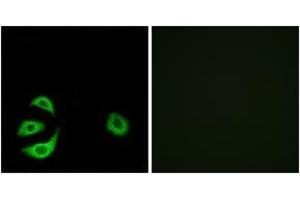 Immunofluorescence analysis of A549 cells, using ACOT8 Antibody. (ACOT8 抗体  (AA 131-180))