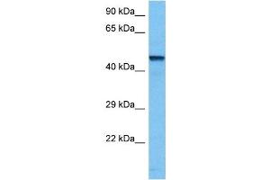 Host:  Mouse  Target Name:  TFAP2B  Sample Tissue:  Mouse Kidney  Antibody Dilution:  1ug/ml (TFAP2B 抗体  (N-Term))