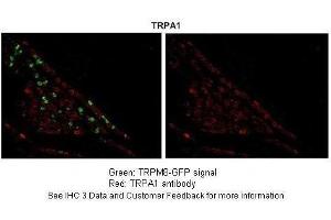 Immunohistochemistry (IHC) image for anti-Transient Receptor Potential Cation Channel, Subfamily A, Member 1 (TRPA1) (Middle Region) antibody (ABIN2776190)