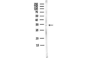anti-Williams Beuren Syndrome Chromosome Region 22 (WBSCR22) antibody