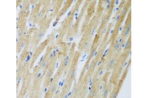 Immunohistochemistry of paraffin-embedded Rat heart using ADAM12 Polyclonal Antibody at dilution of 1:100 (40x lens). (ADAM12 抗体)