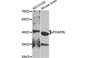 Western blot analysis of extracts of NCI-H125 and mouse brain cell lines, using PDGFRL antibody. (PDGFRL 抗体)