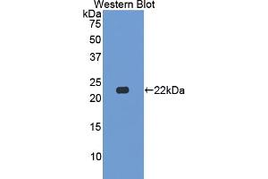 Western blot analysis of the recombinant protein. (CSN2 抗体  (AA 41-198))