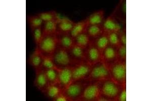 Immunofluorescenitrocellulosee of human MCF7 cells stained with Phalloidin-TRITC (Red) for Actin staining and monoclonal anti-human MAPK1 antibody (1:500) with Alexa 488 (Green). (ERK2 抗体)