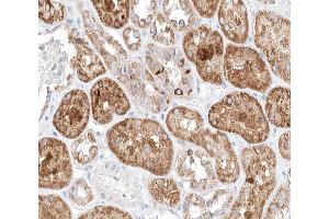 ABIN6266642 at 1/100 staining human kidney tissue sections by IHC-P. (TGFB3 抗体)