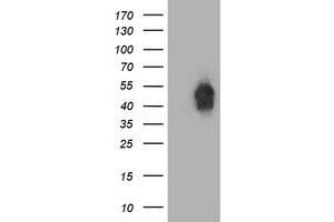 Western Blotting (WB) image for anti-Beclin 1, Autophagy Related (BECN1) antibody (ABIN1496866)