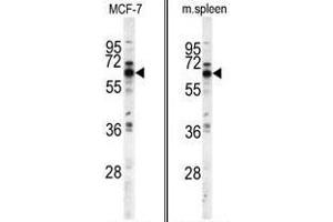 (LEFT) Western blot analysis of PANK1 antibody (N-term) in MCF-7 cell line lysates (35ug/lane).