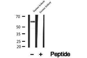 Western blot analysis of extracts of human kidney tissue, using SRP68 antibody. (SRP68 抗体  (C-Term))