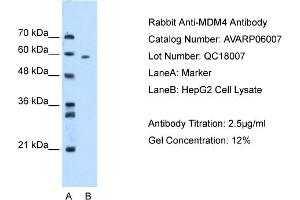 WB Suggested Anti-MDM4 AntibodyTitration: 2. (MDM4-binding Protein 抗体  (N-Term))