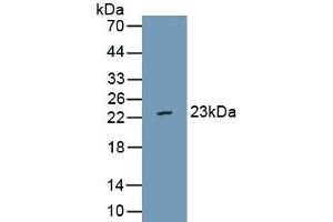Detection of Recombinant vWA5B2, Human using Polyclonal Antibody to Von Willebrand Factor A Domain Containing Protein 5B2 (vWA5B2) (VWA5B2 抗体  (AA 354-527))
